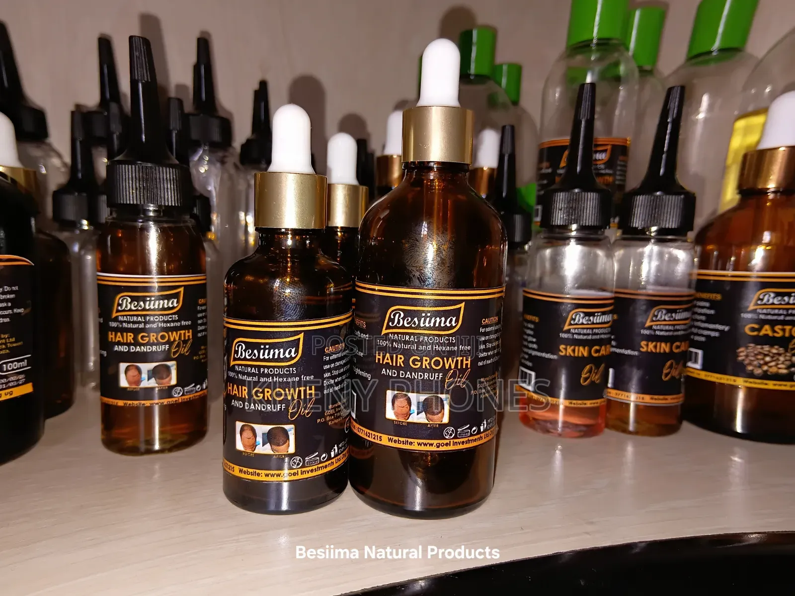 Hair Growth and Dandruff