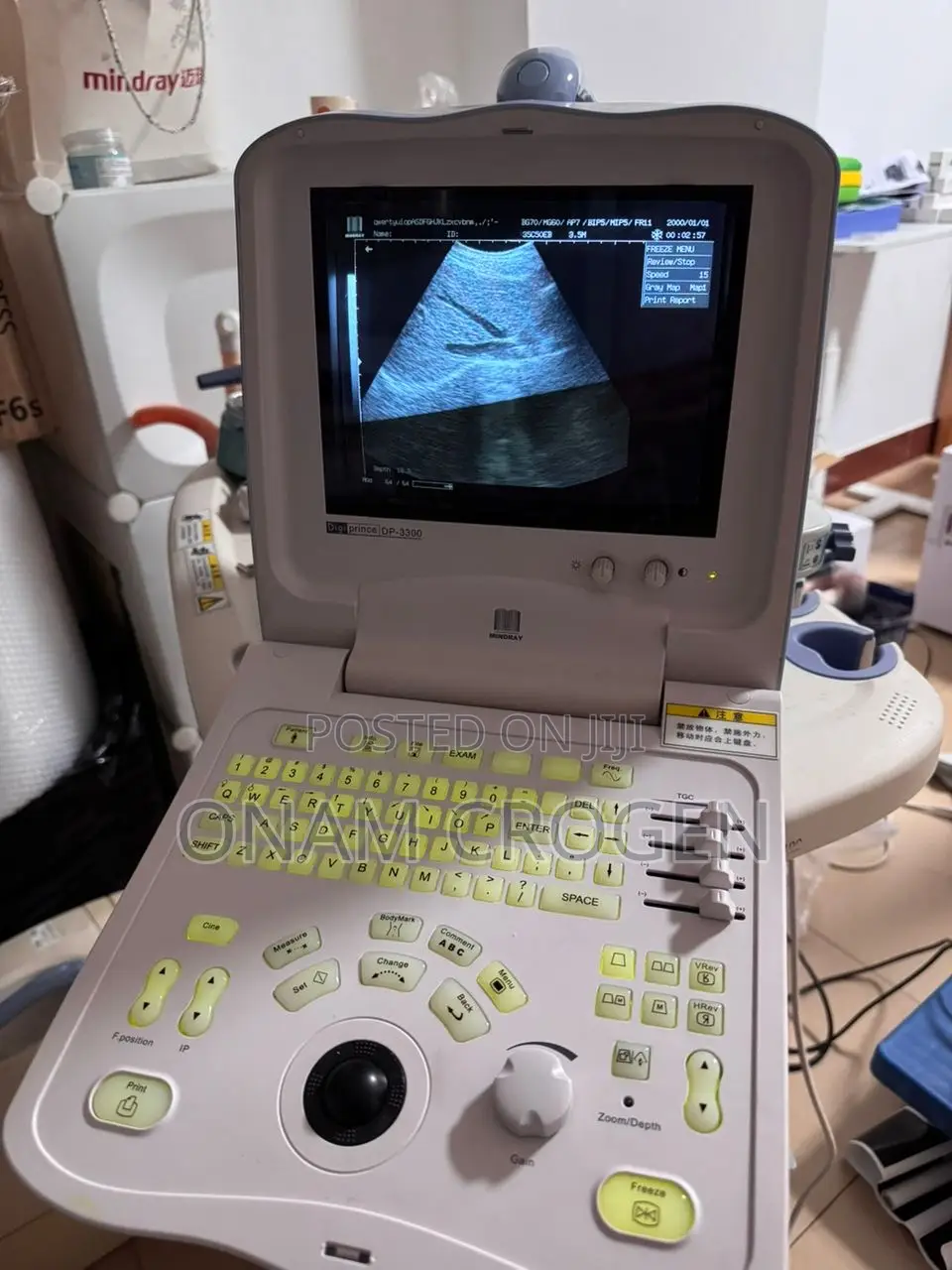 Mindray Dp 3300 Premium
