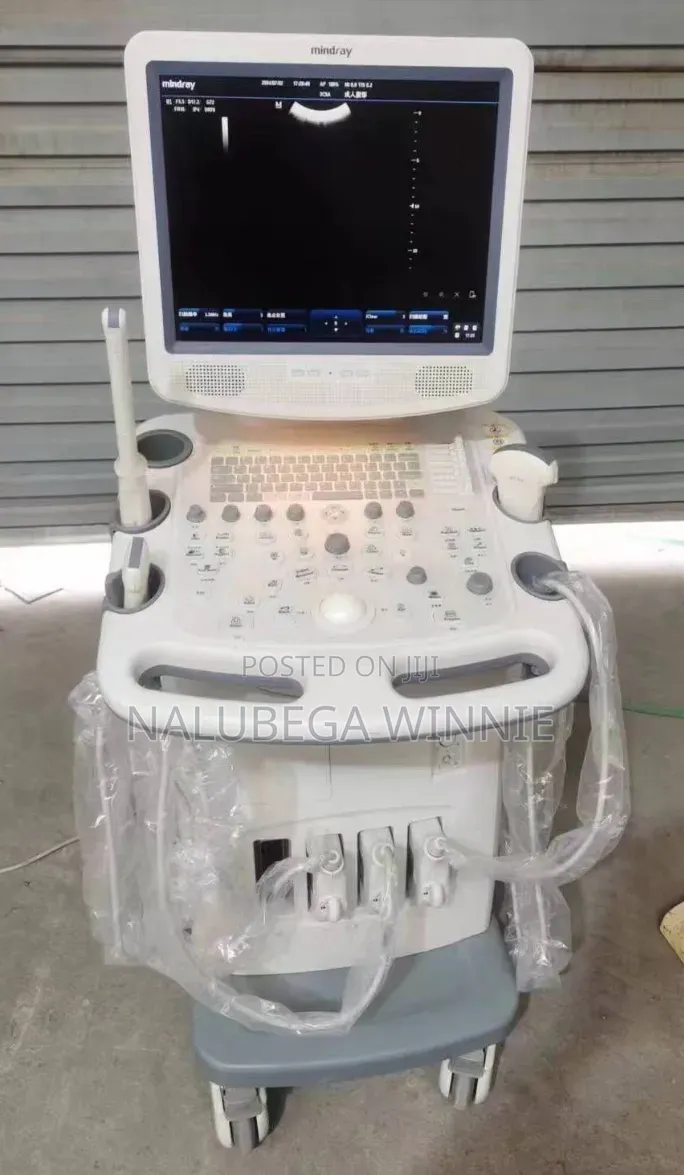 Mindray Dc 3 Ultrasound Scan