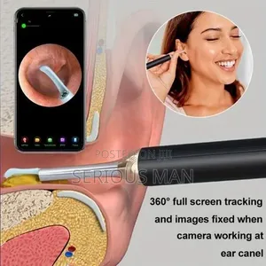 Inteligent Visual Ear Wax Removal Cleaner Tool With Hd Otoscope Camera