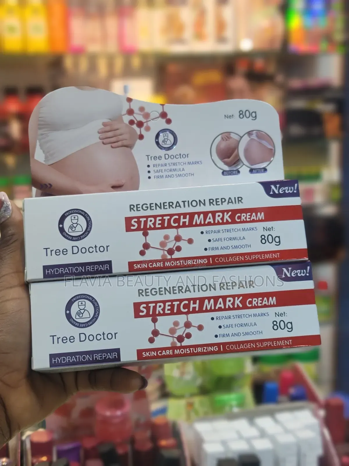 Stretch Mark Removal Cream.Tree Doctor