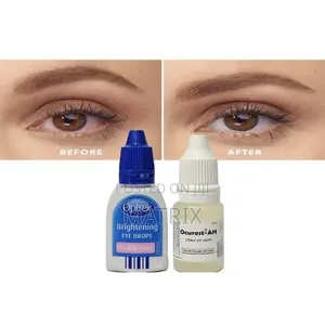 Eye Whitener Instant Dazzling Bright Eyes Eye Whitening Drops Optrex