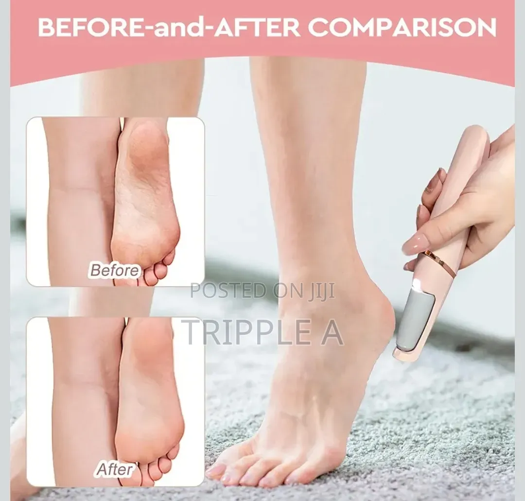 Electric Pedicure Foot File Callus Remover