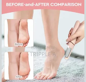 Electric Pedicure Foot File Callus Remover