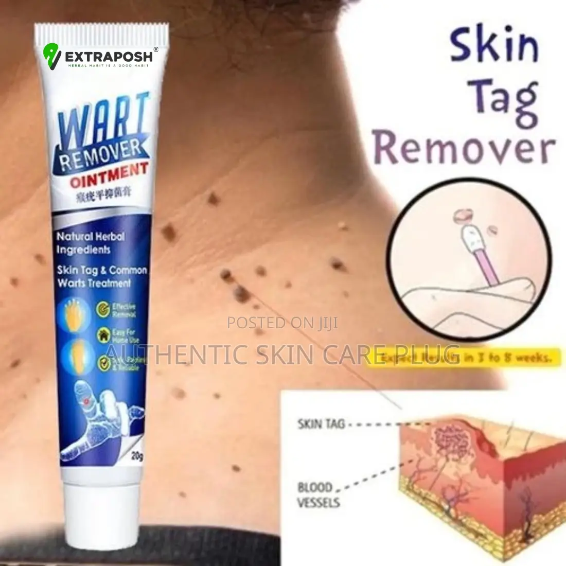 Dr Speckle Killer Effective Wart Removal Solution
