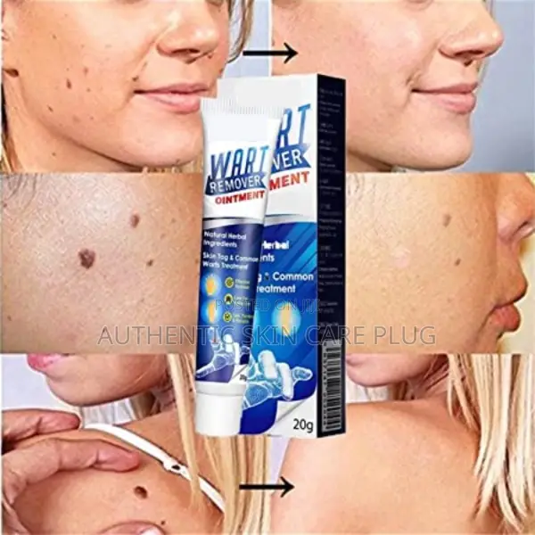 Dr Speckle Killer Effective Wart Removal Solution