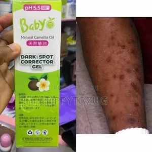 Dark Spot Corrector Gel