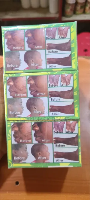 Skin Rush ,Burns Harbel Soap