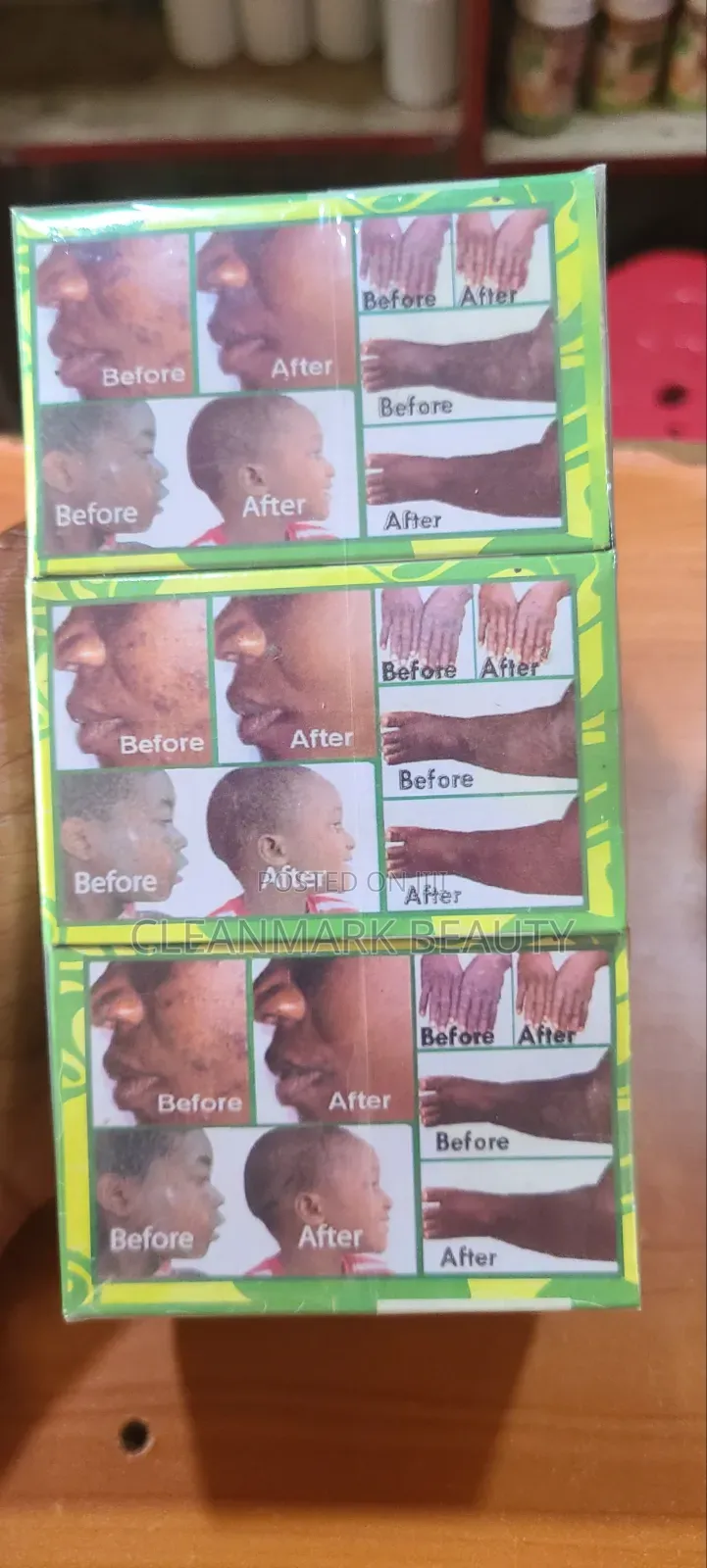 Skin Rush ,Burns Harbel Soap