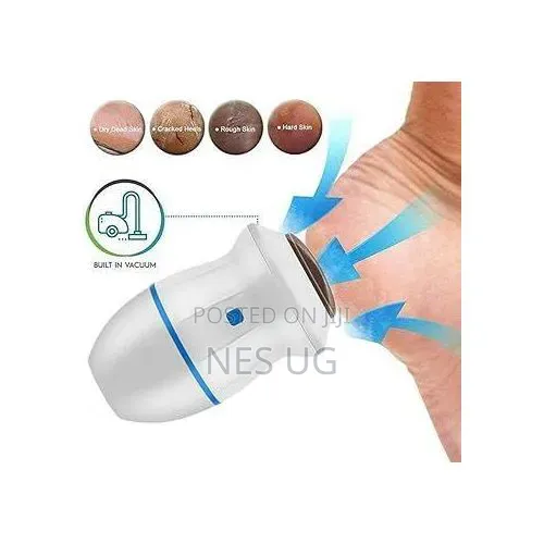 Electric Dead Skin Foot Callus Remover