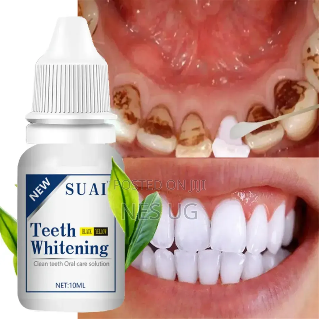 Teeth Whitening Solution