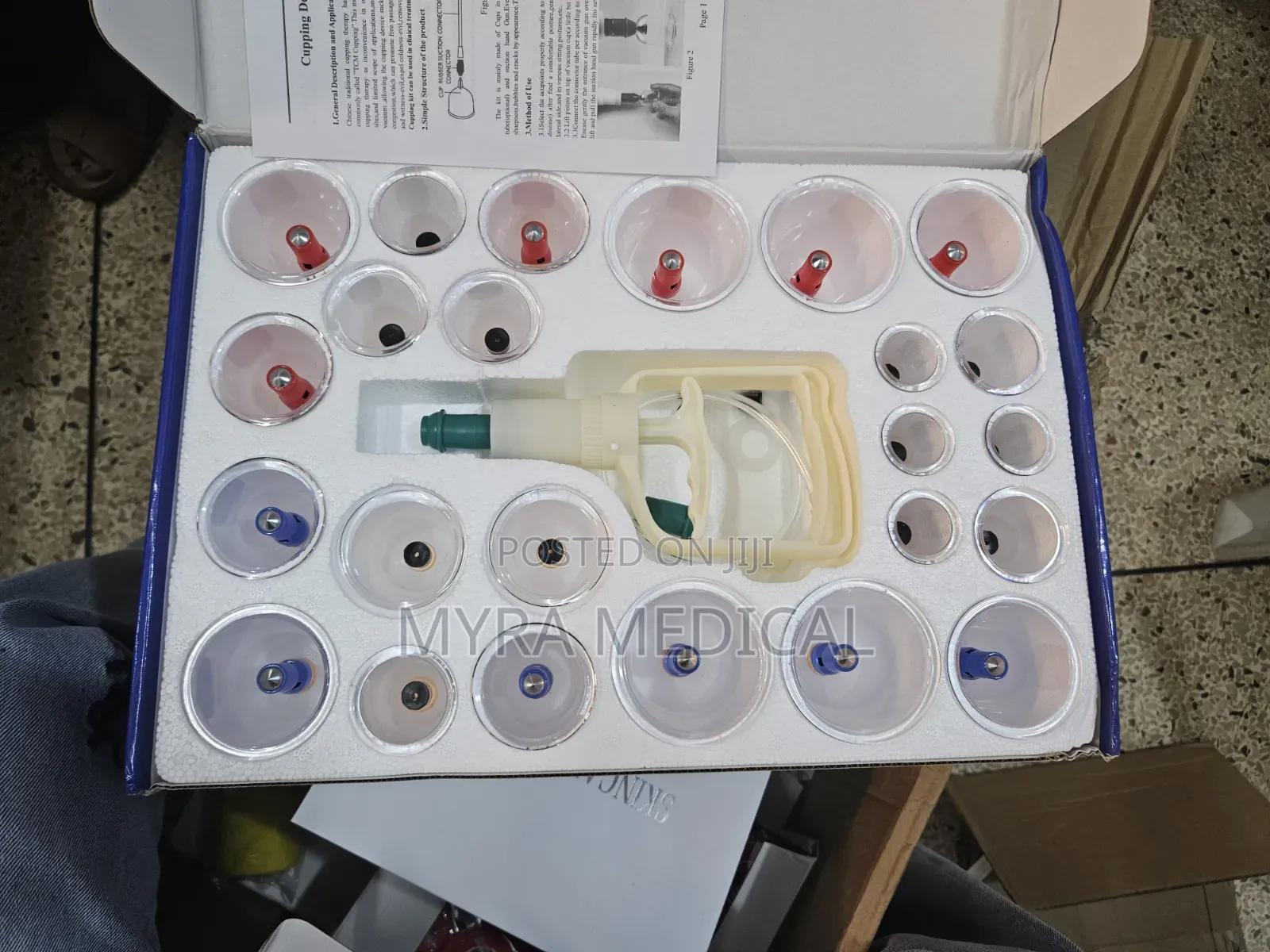 Vacuum Cupping Device