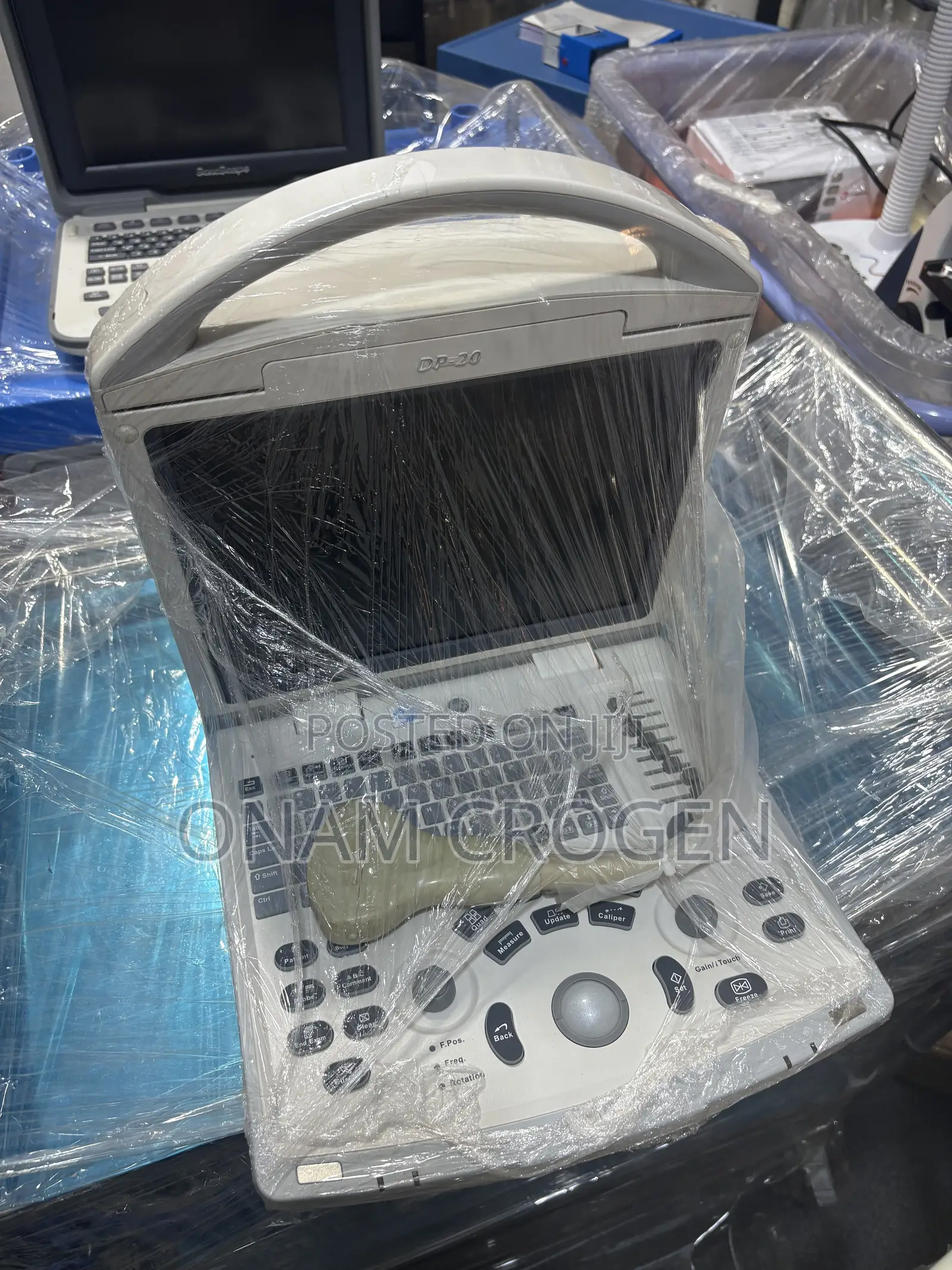 Mindray Dp 20 Cx Uk Ultrasound Machine