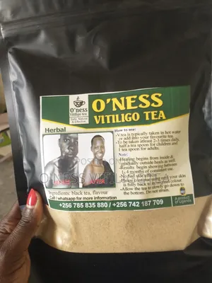 Vitiligotea