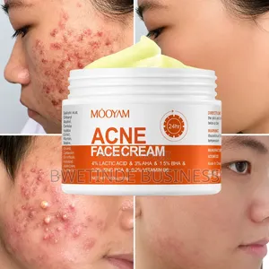 Herbal Acne Removal Cream