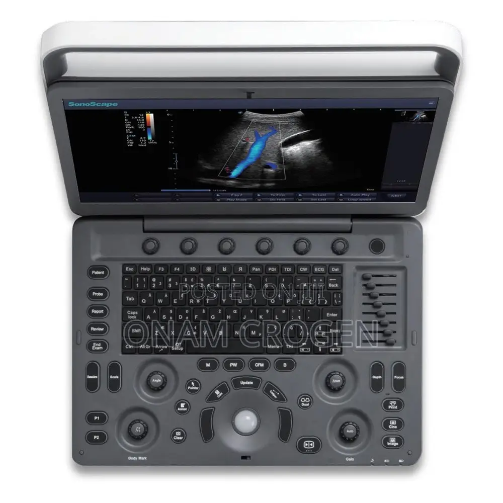 Sonoscape E2 Color Doppler Mm