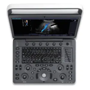 Sonoscape E2 Color Doppler Mm