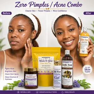 Zero Pimples / Acne Combo