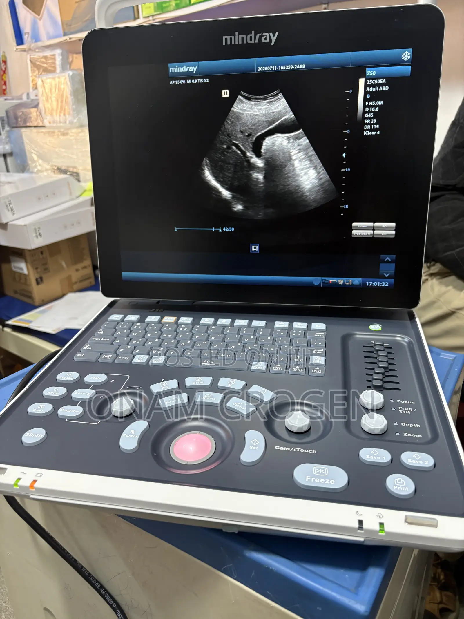 Mindray Z50 Three Probes Yy3