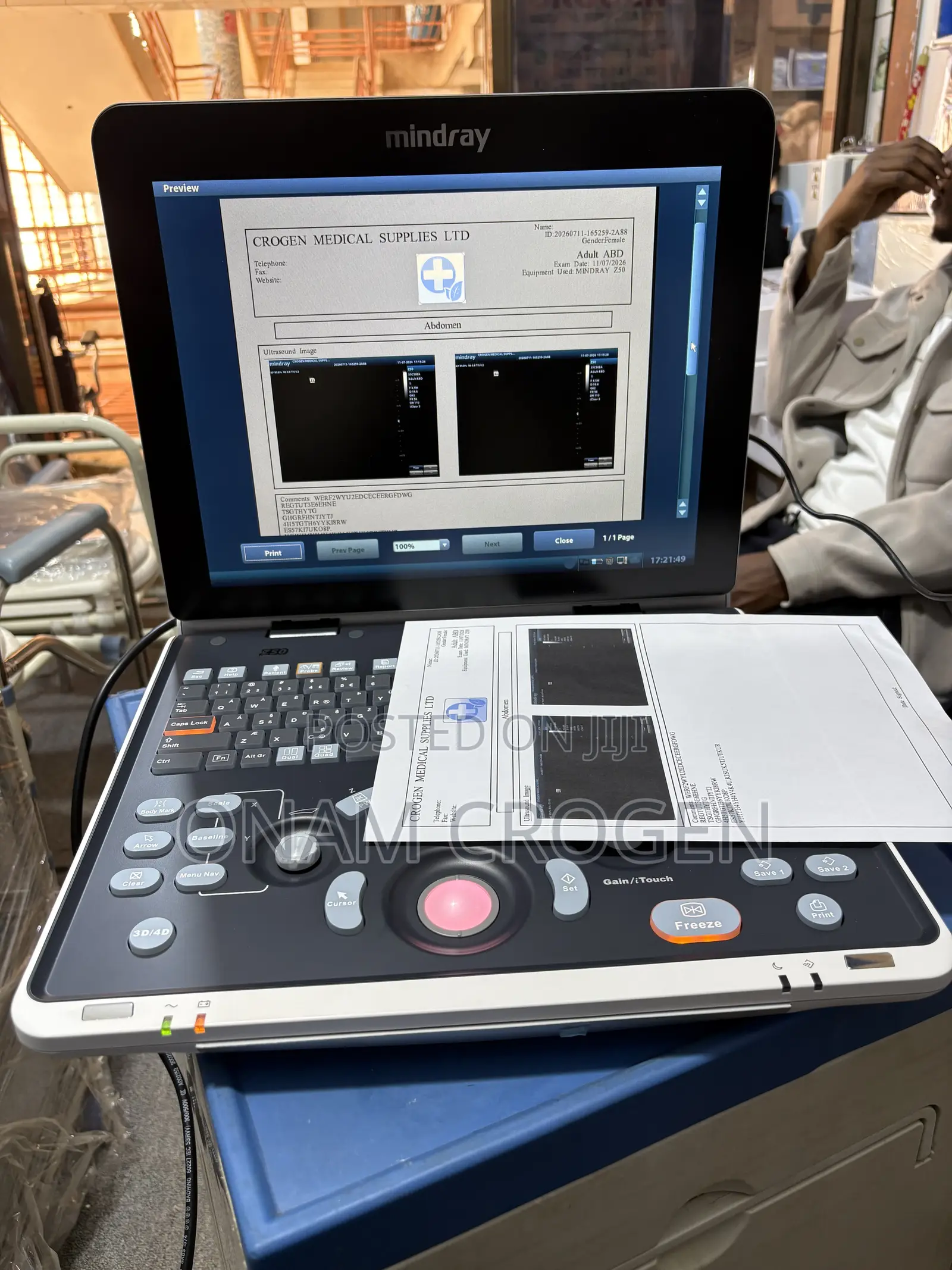 Mindray Z50 Three Probes Yy3