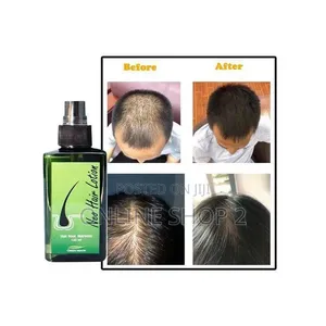 Neo Hair Lotion