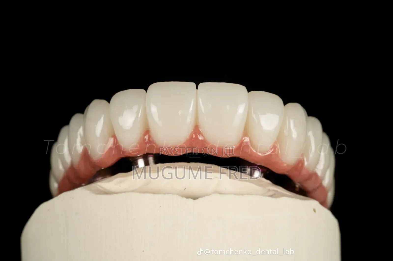 Smile Make Over