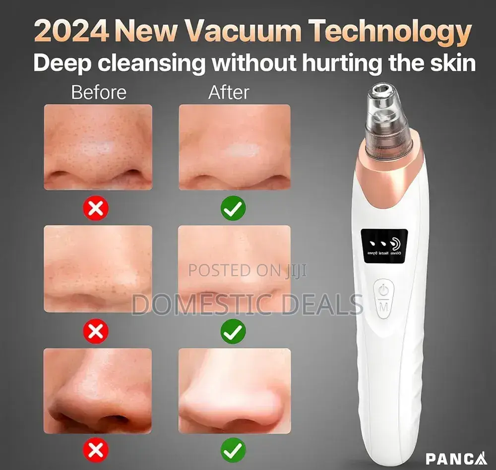 Blackhead Remover Machine