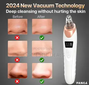 Blackhead Remover Machine