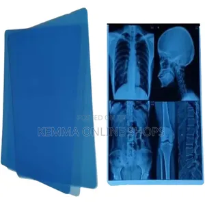 Accoson Wall Aneroid Sphygmomanometer