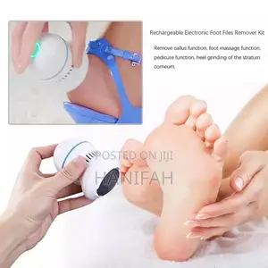 Callus Removal