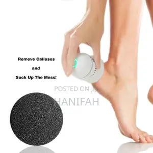 Callus Removal