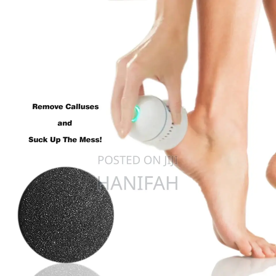 Callus Removal