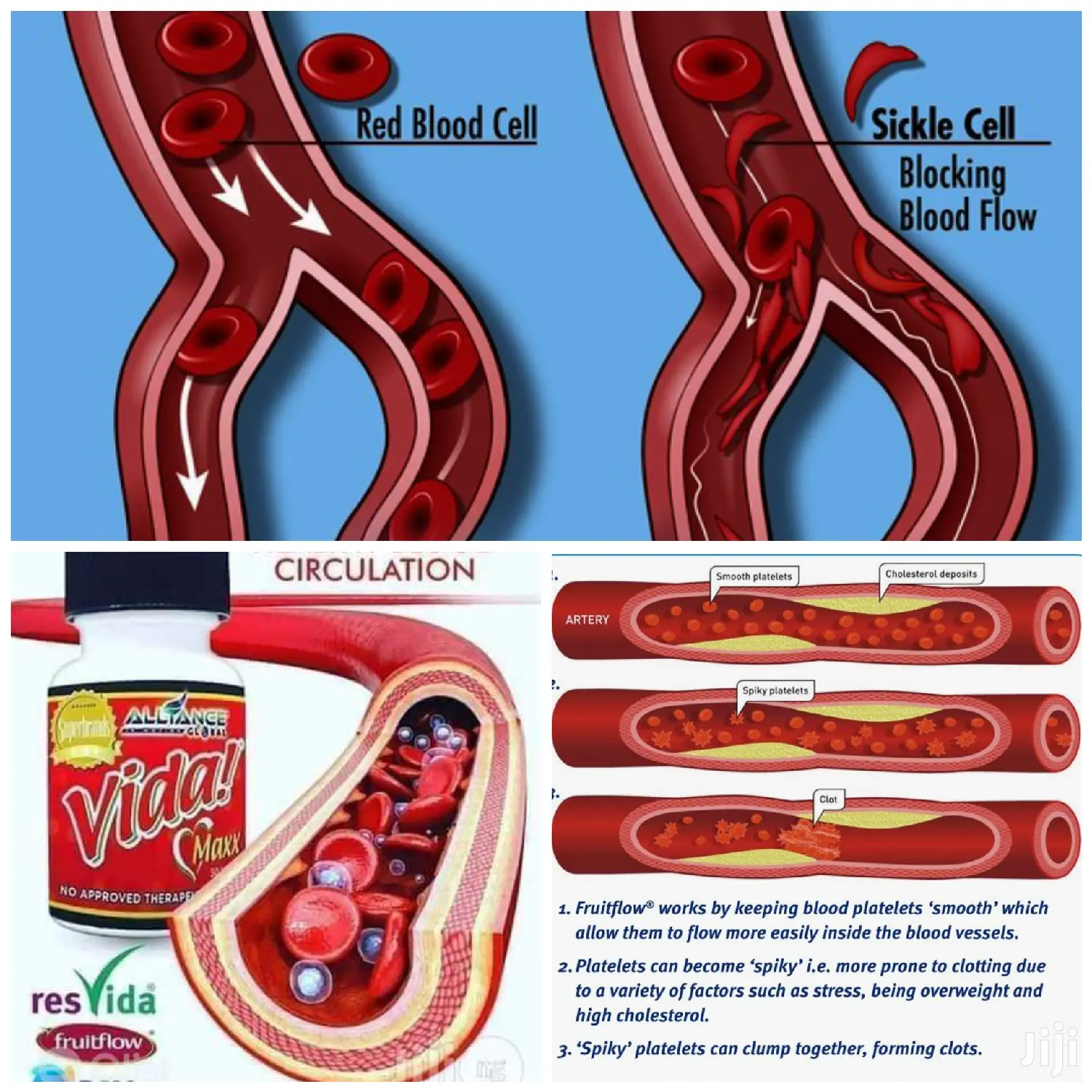 Vidamax Sickle Cell Crisis Reliever