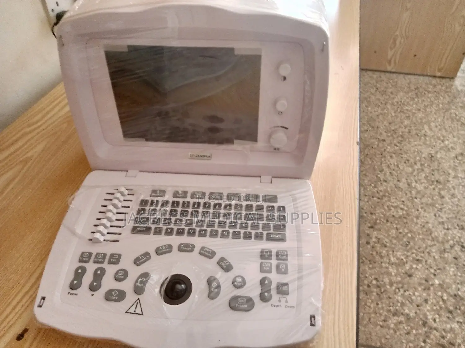 Mindray Ultrasound Scan Dp 2200 Plus