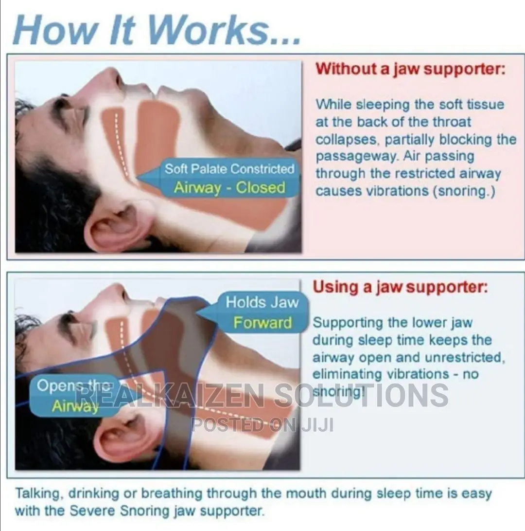 Anti Snore Stop Snoring Belt Unisex Chin Strap