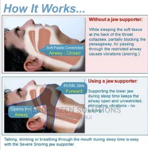 Anti Snore Stop Snoring Belt Unisex Chin Strap