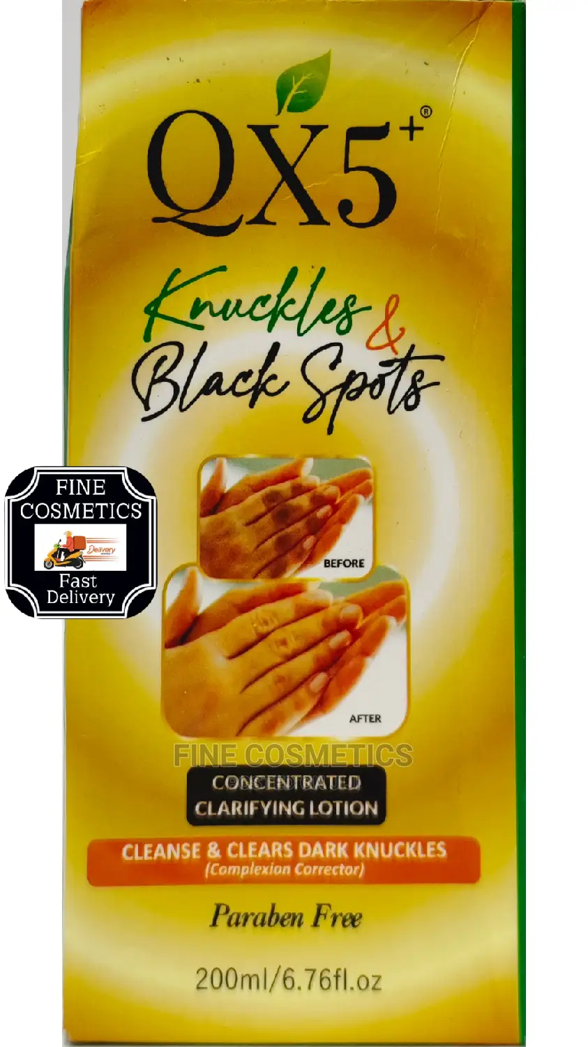 QX5+ Knuckles and Dark Spots Removal Cream